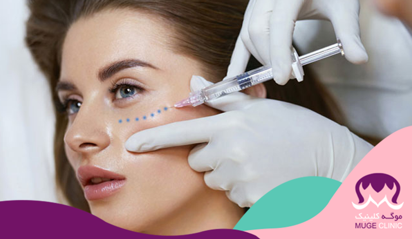 مزوبوتاکس ( Mesobotox )