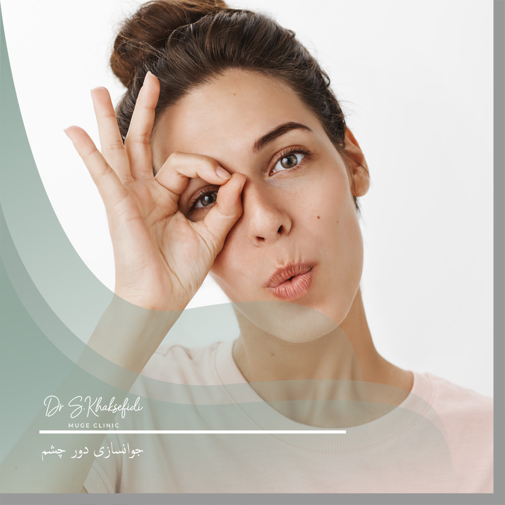 Dark-circles-under-the-eyes