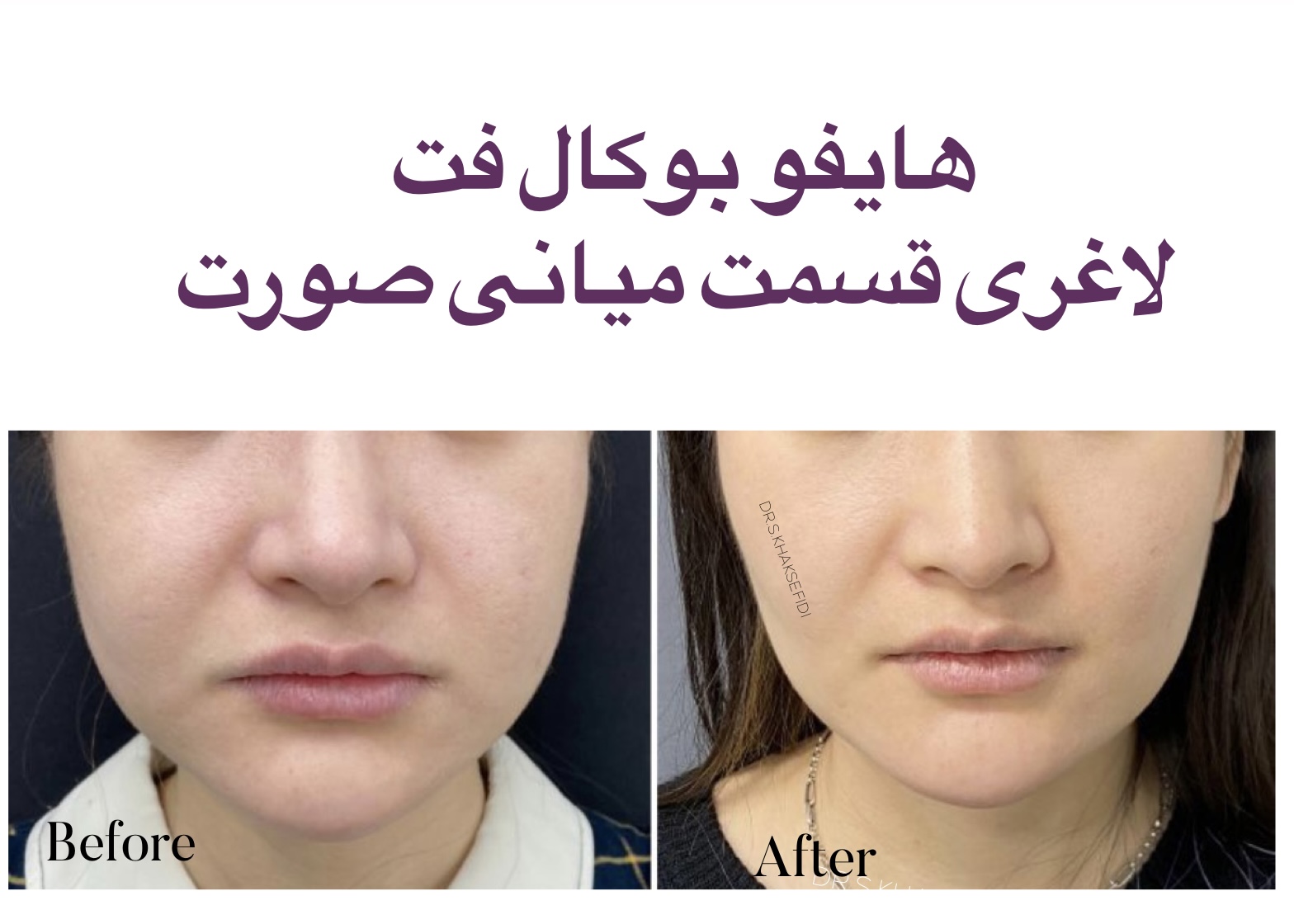 {PinterestId: 190777}